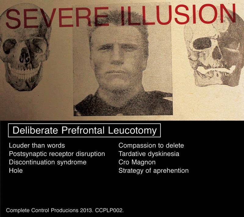 Severe Illusion - Deliberate Prefrontal...